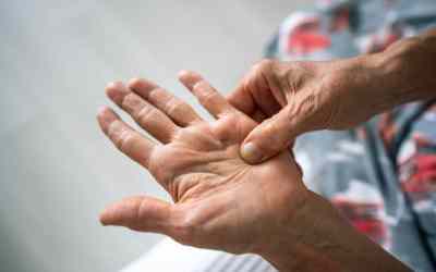 Dupuytren’s Contracture Treatment in Vancouver: Effective Options for Hand Conditions