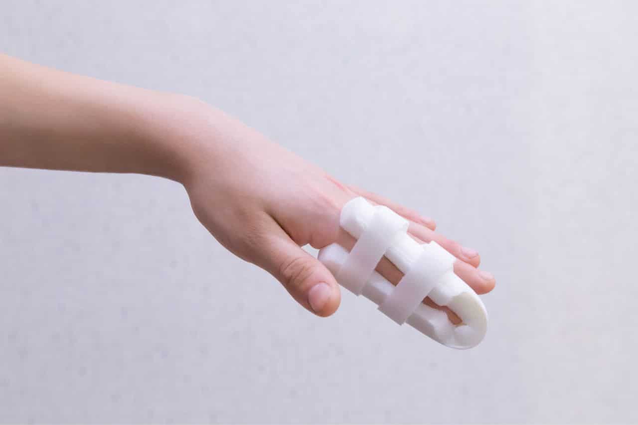 mallet finger treatment in Vancouver